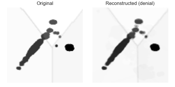 Denial reconstruction